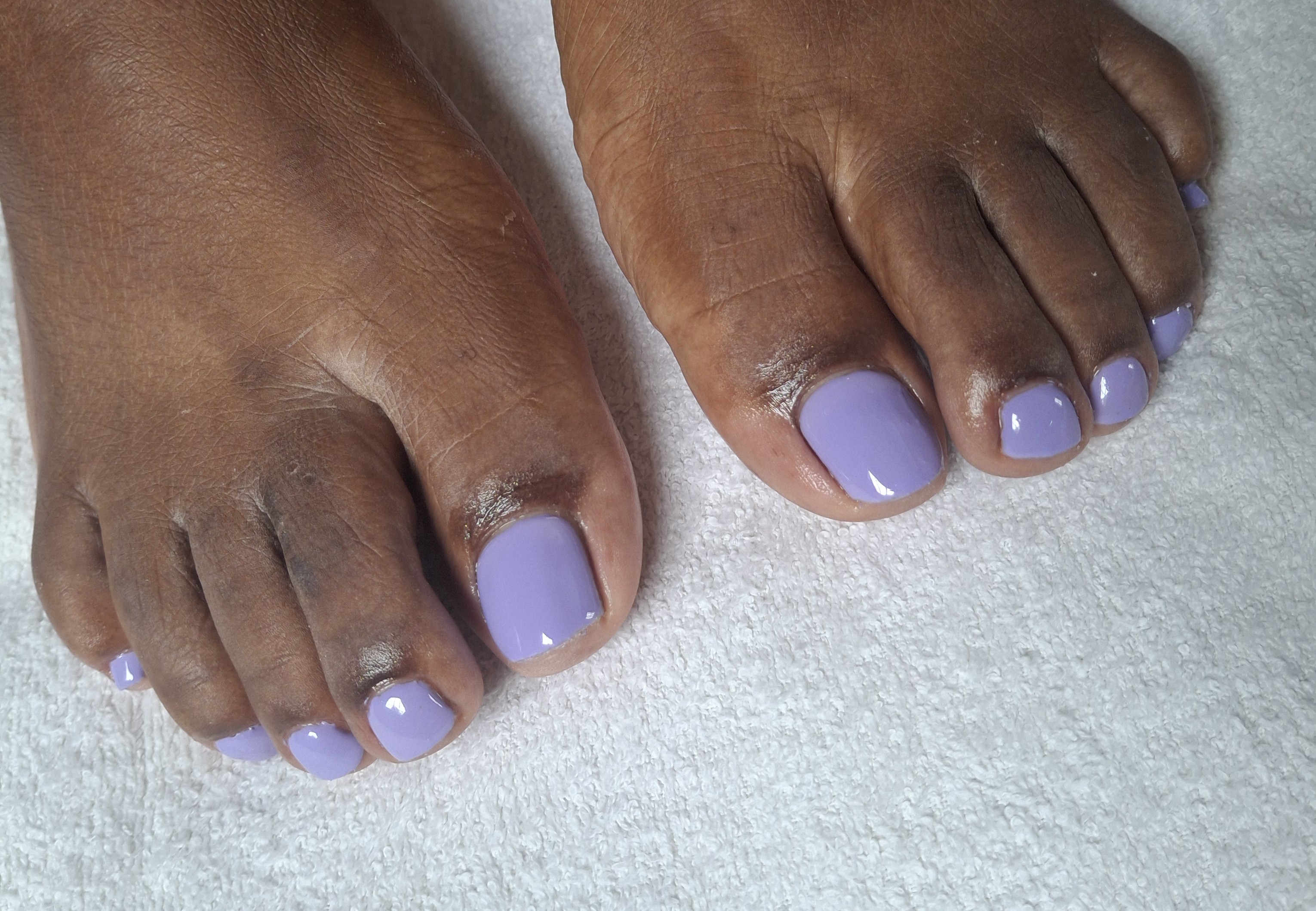 Gel on Toes